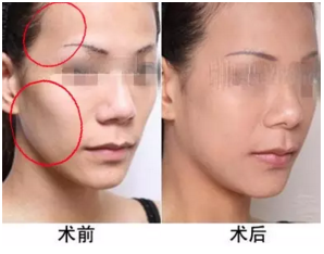 鼻基底技術(shù)革新,觀點論述與突破