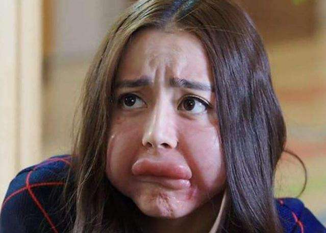 香腸嘴女演員,審美多元性與公眾視角的碰撞探究