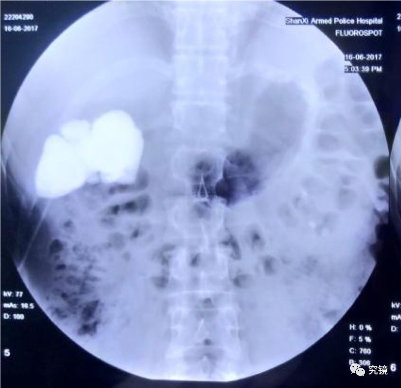 最新結(jié)石作品璀璨閃耀,火熱出爐!